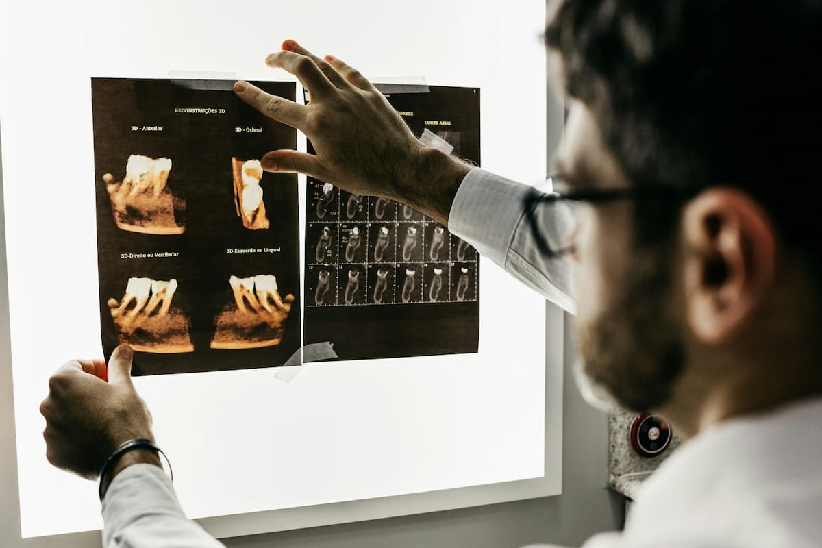 dentist looking at xray of teeth and gums