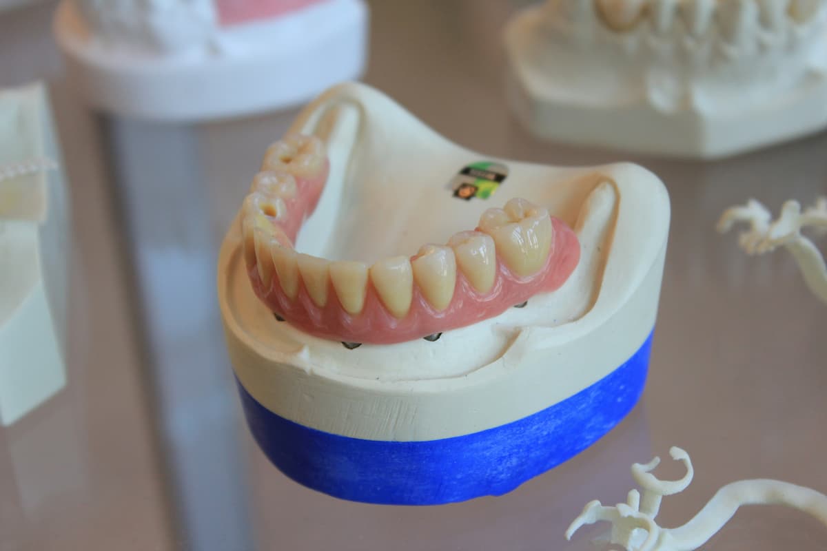 set of dentures being made