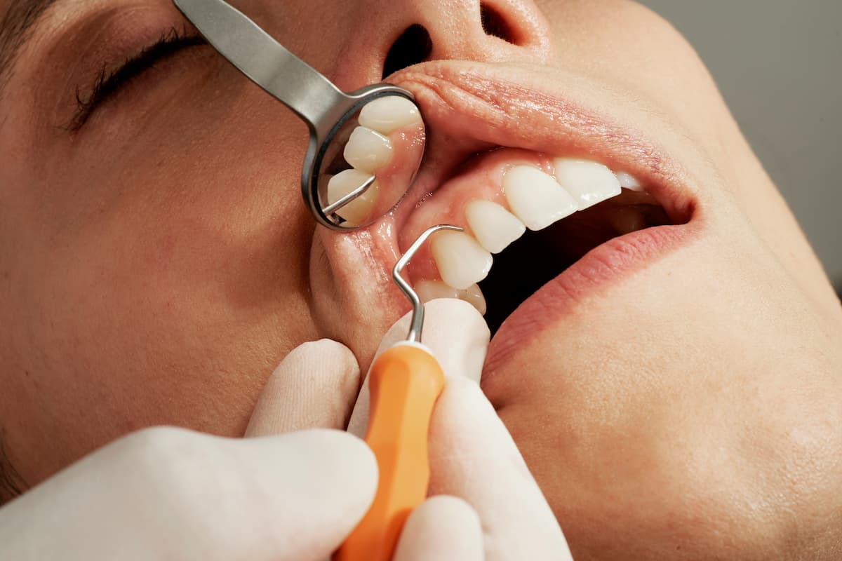 person getting exam for malocclusion